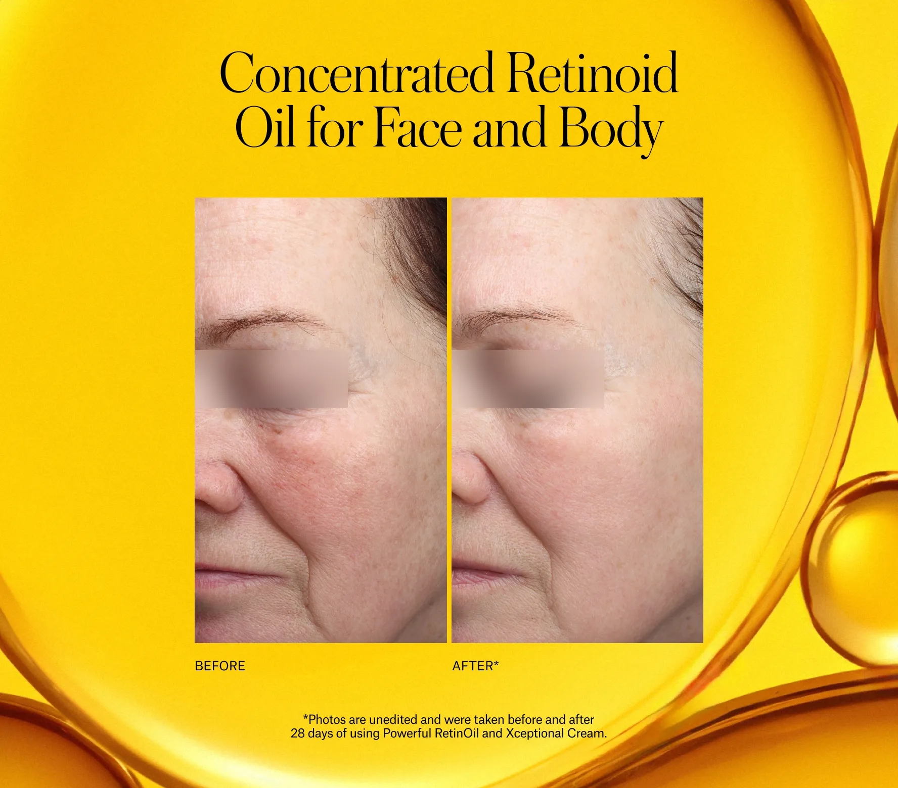 Powerful RetinOil Next-Gen