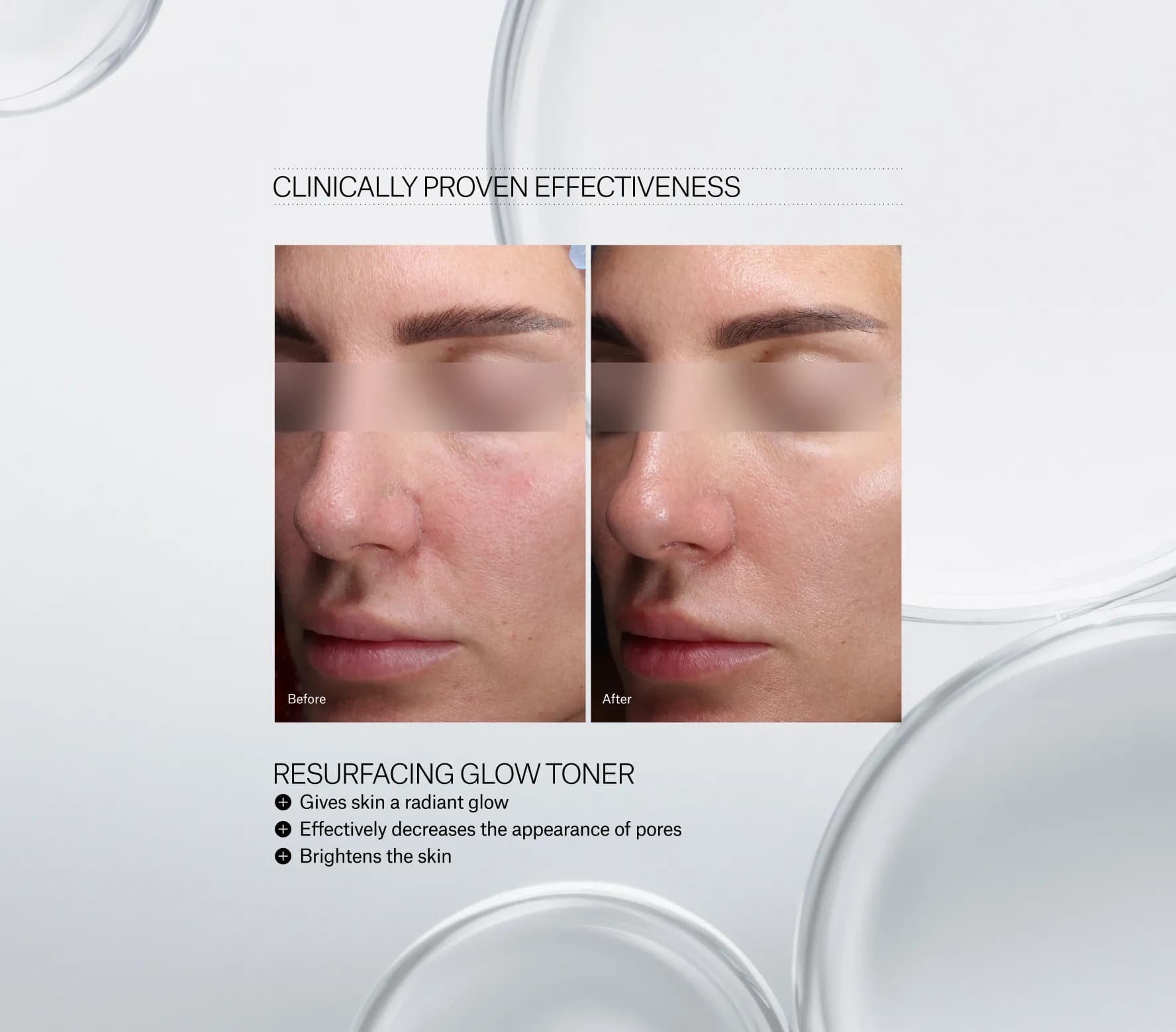 Resurfacing Glow Toner Next-Gen