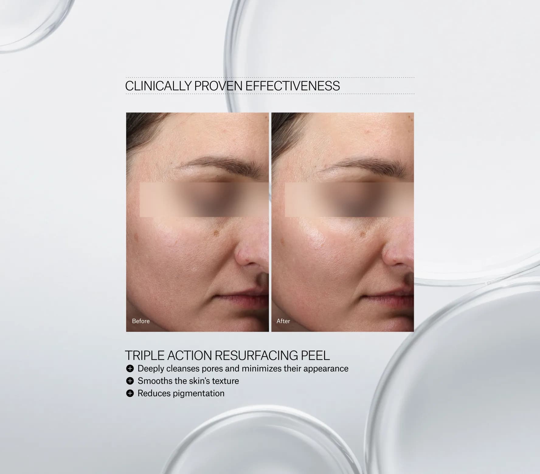 Triple Action Resurfacing Peel Next-Gen