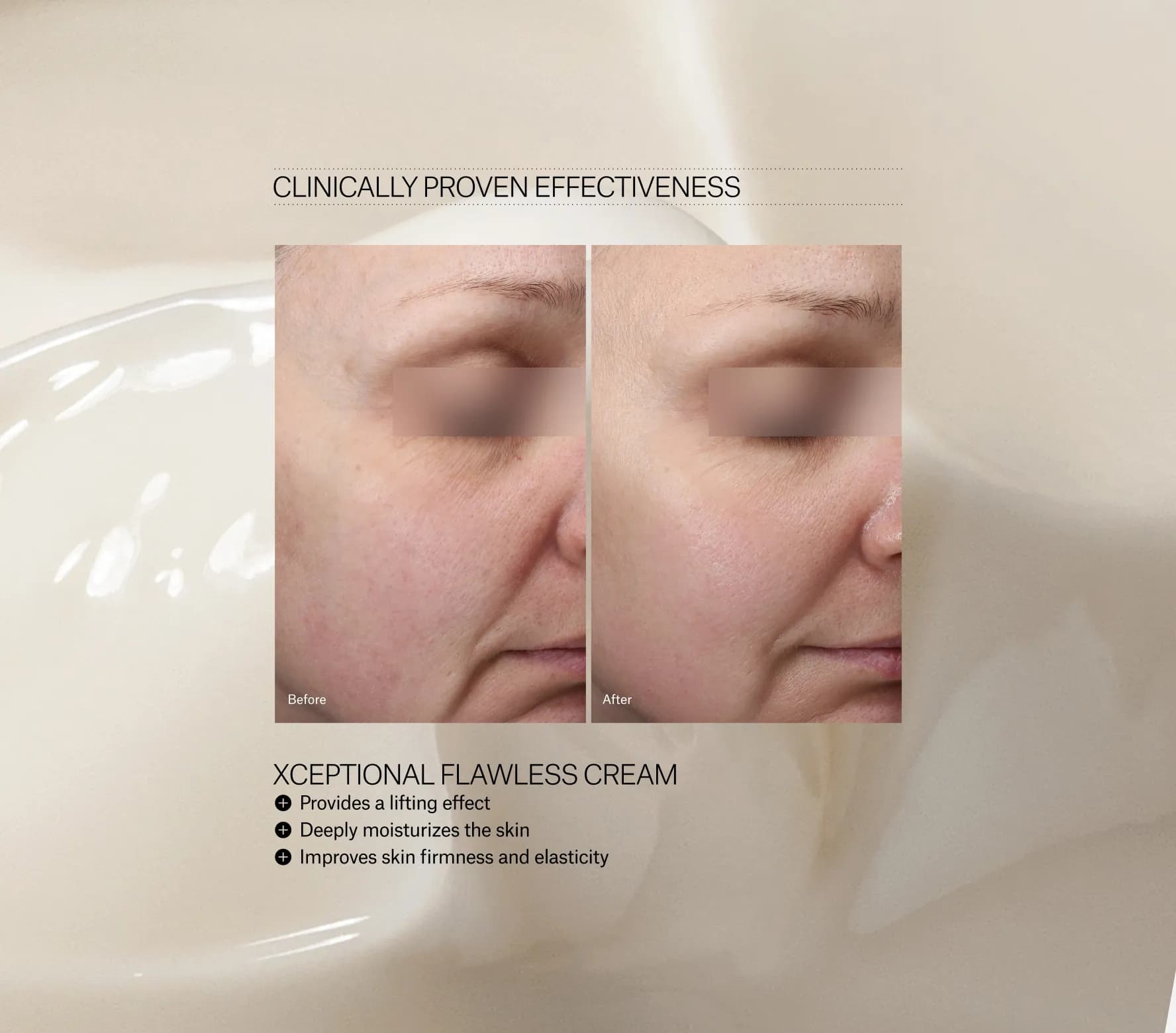 Xceptional Flawless Cream Next-Gen