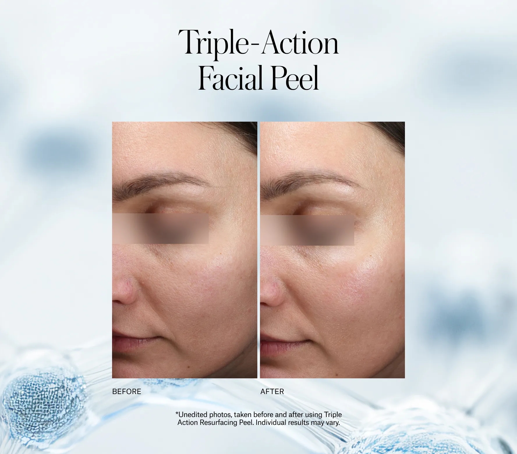 Triple Action Resurfacing Peel Next-Gen