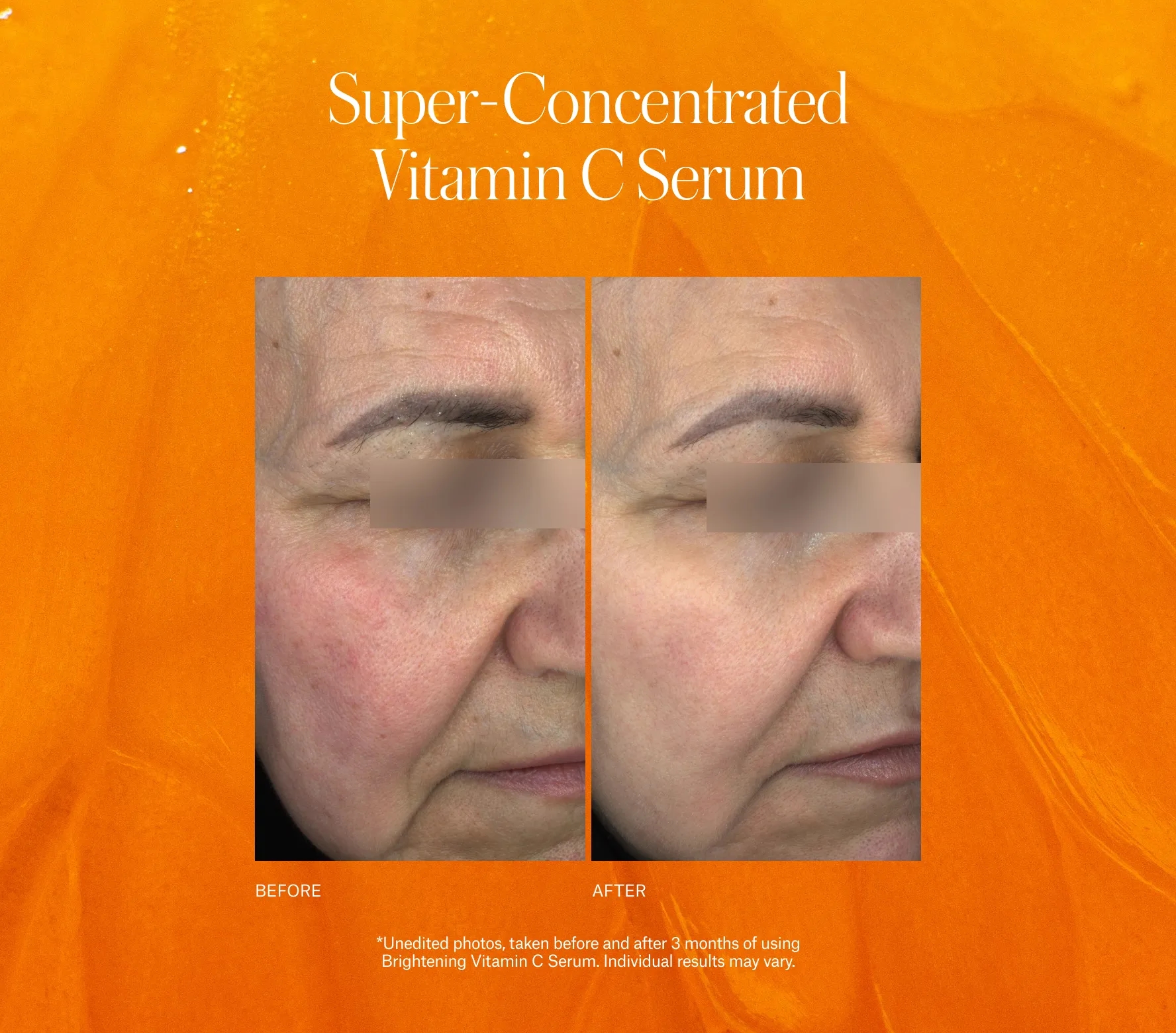 Brightening Vitamin C Serum Next-Gen