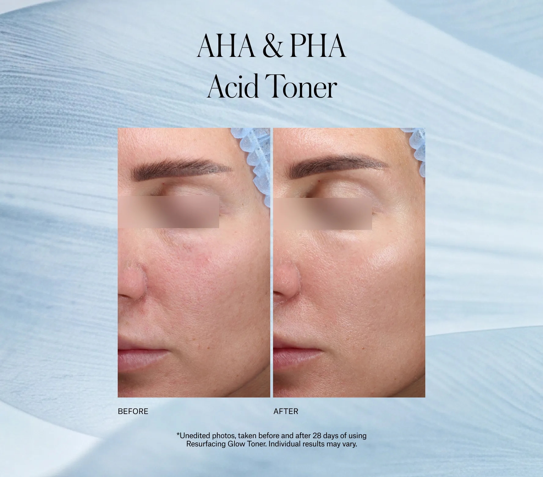 Resurfacing Glow Toner Next-Gen