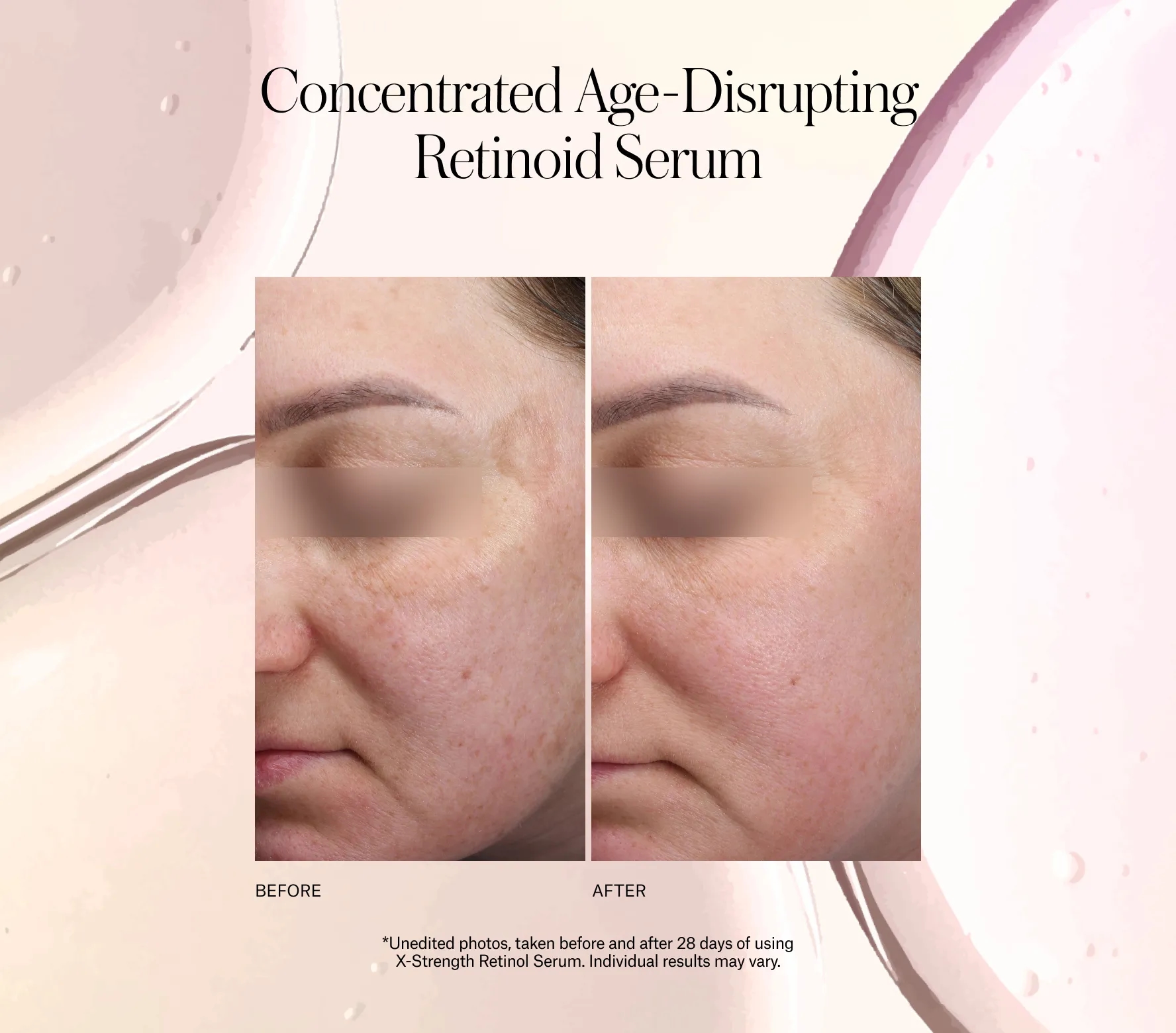 X-Strength Retinol Serum Next-Gen
