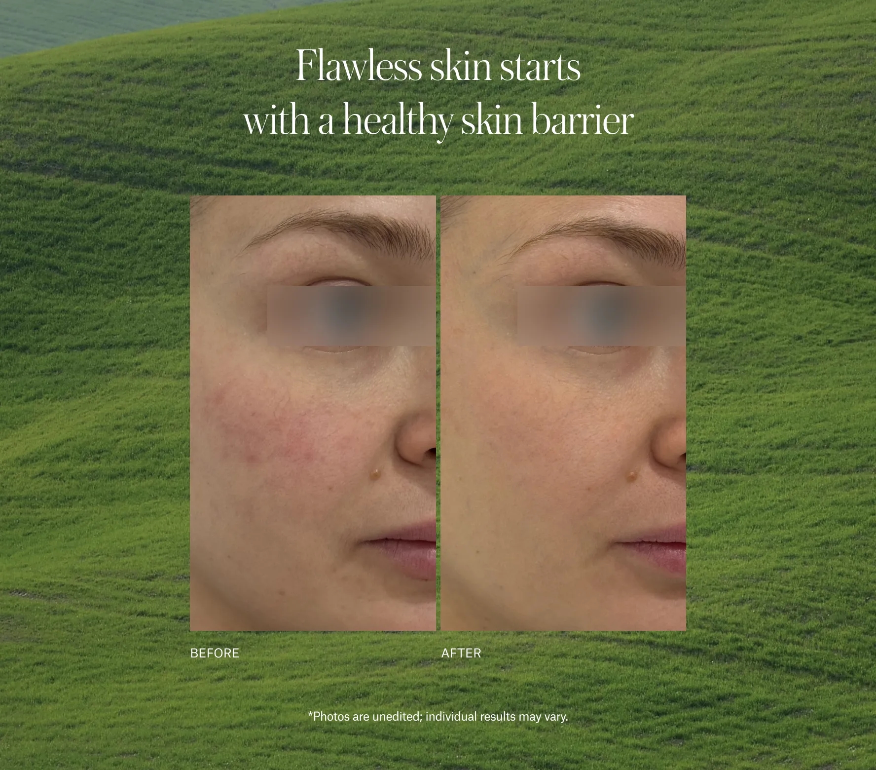 SuperBiotic Regenerating Cream Next-Gen