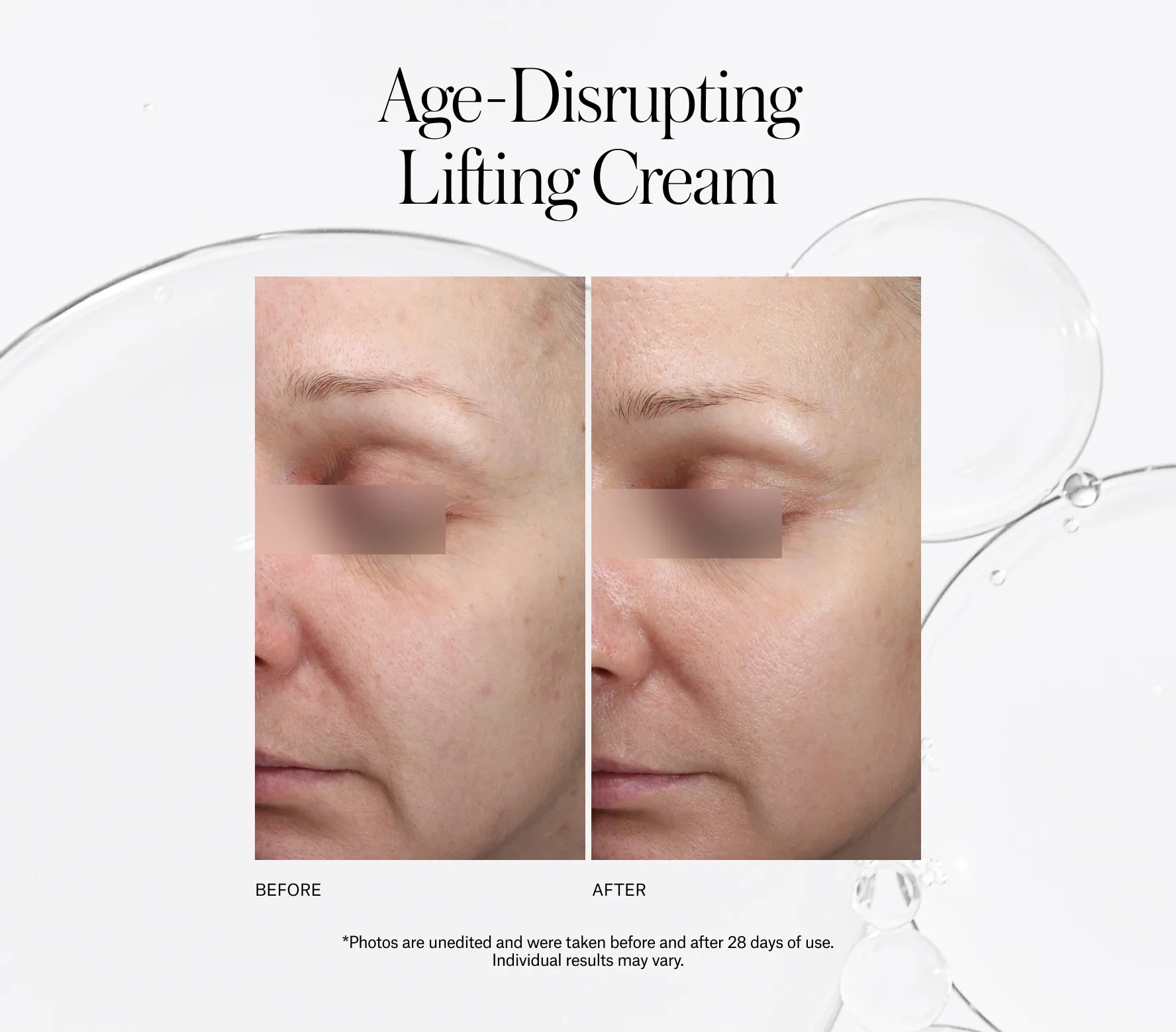 Xceptional Flawless Cream Next-Gen