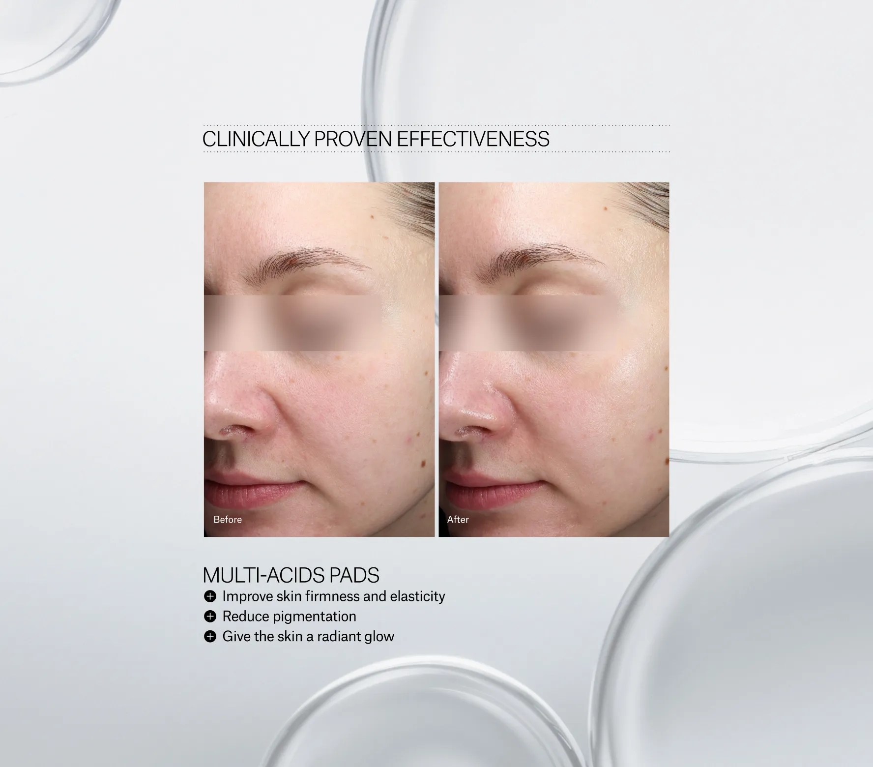 Resurfacing Multi-Acids Pads Next-Gen