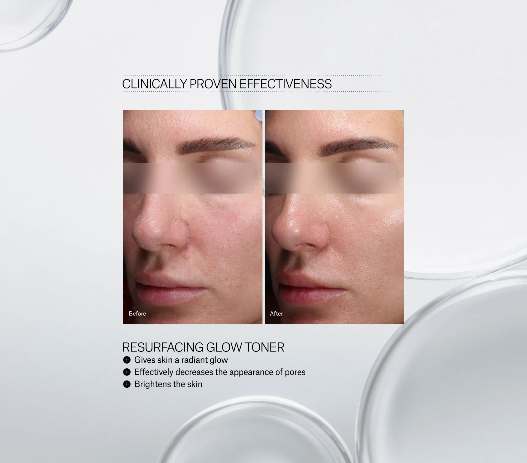 Resurfacing Glow Toner Next-Gen