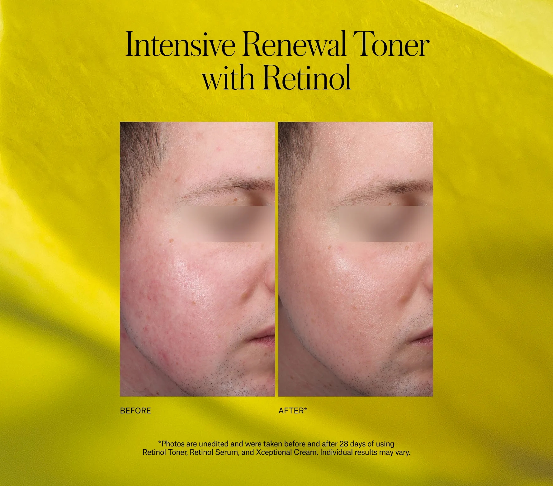 Advanced Retinol Toner Next-Gen