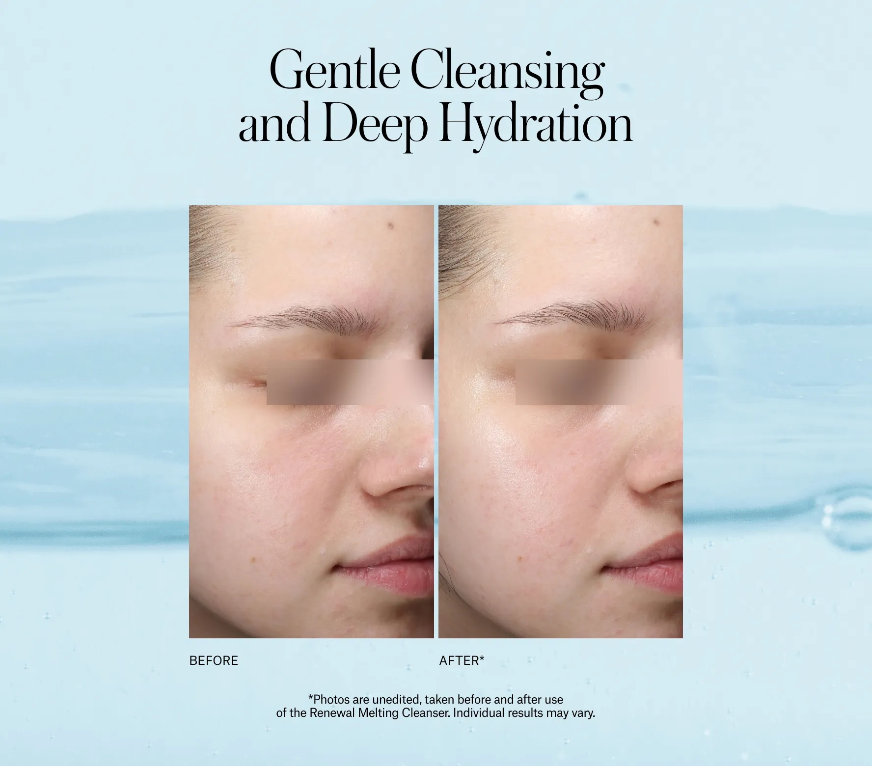 Renewal Melting Cleanser Next-Gen