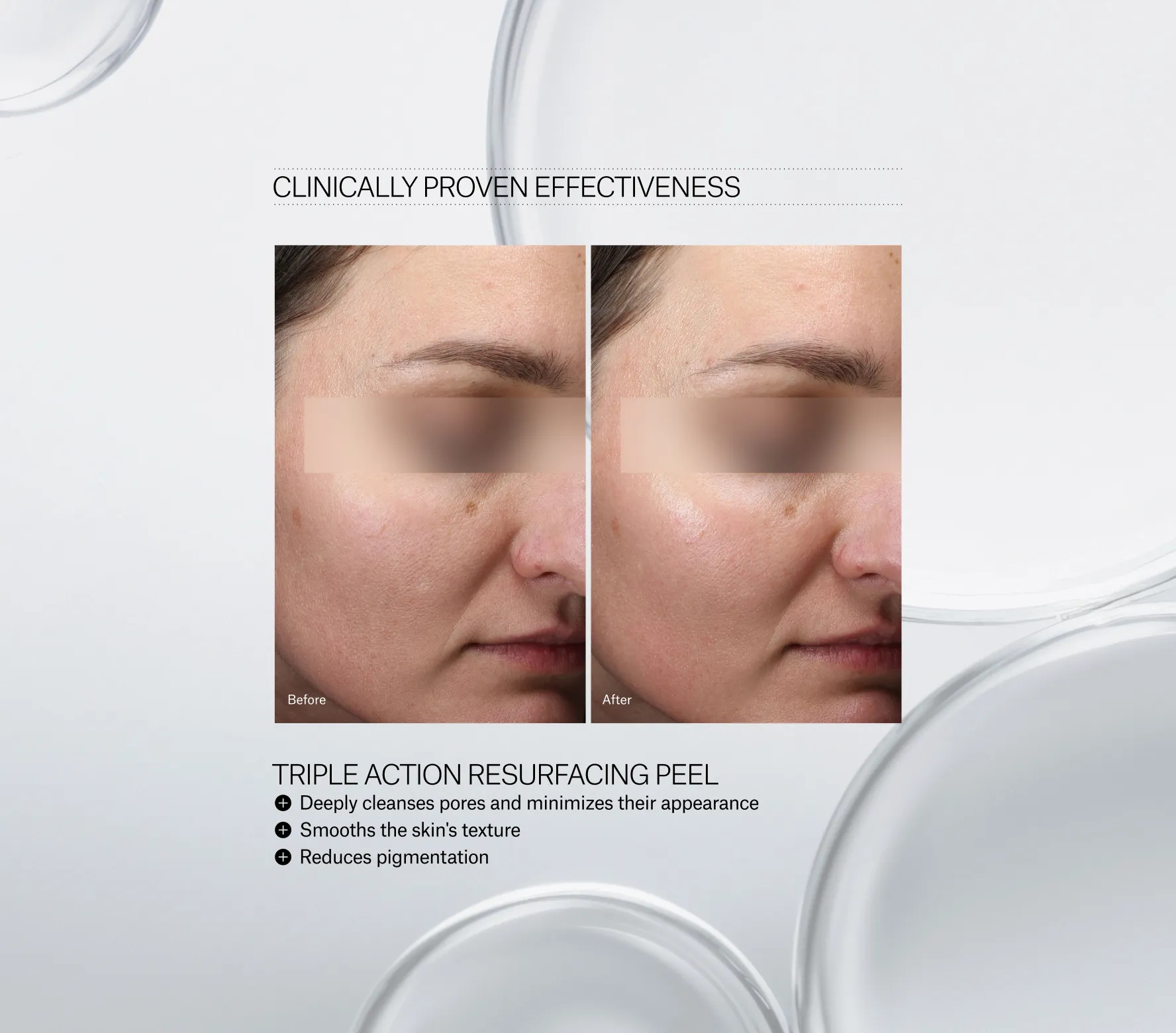 Triple Action Resurfacing Peel Next-Gen