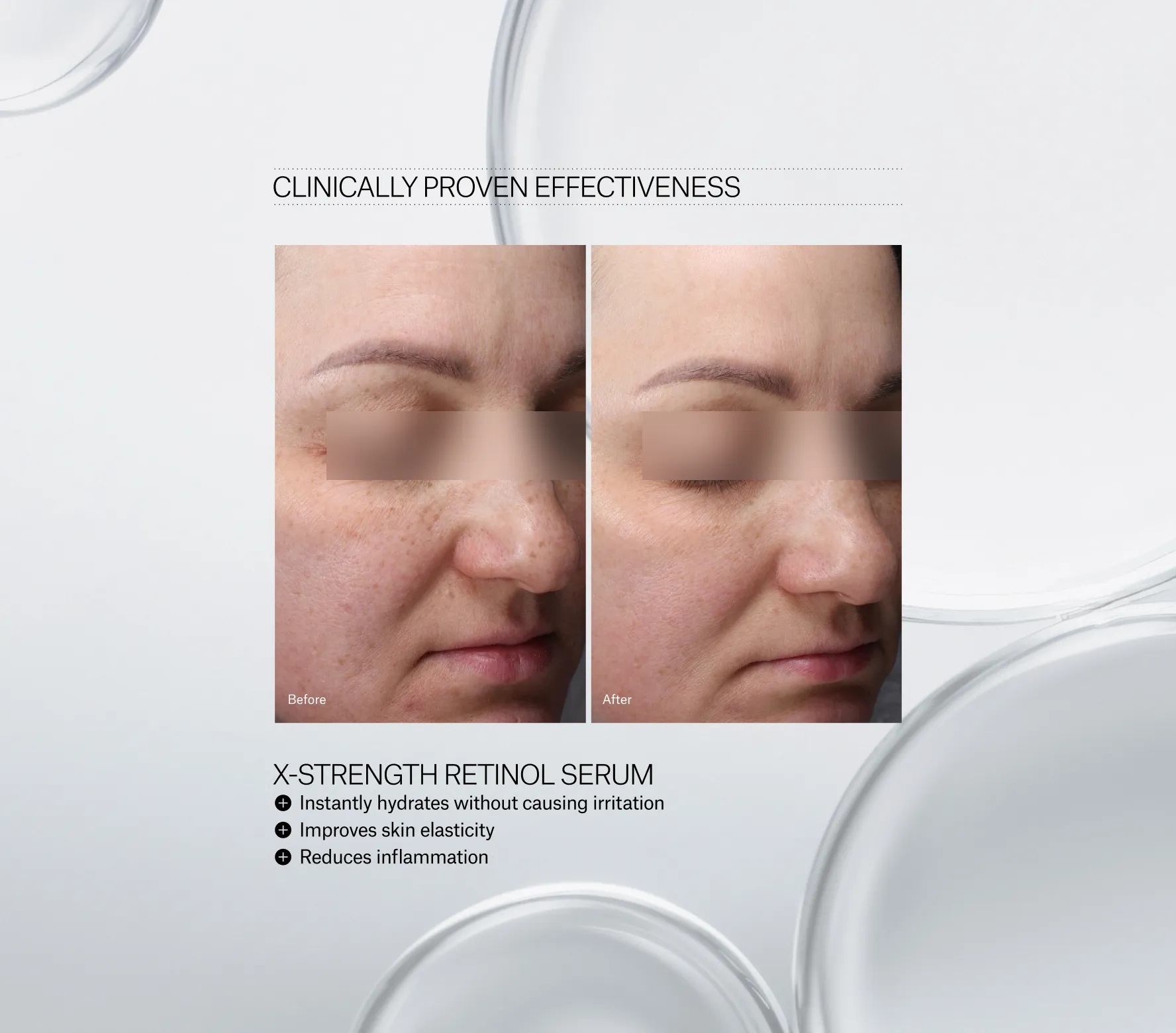 X-Strength Retinol Serum Next-Gen