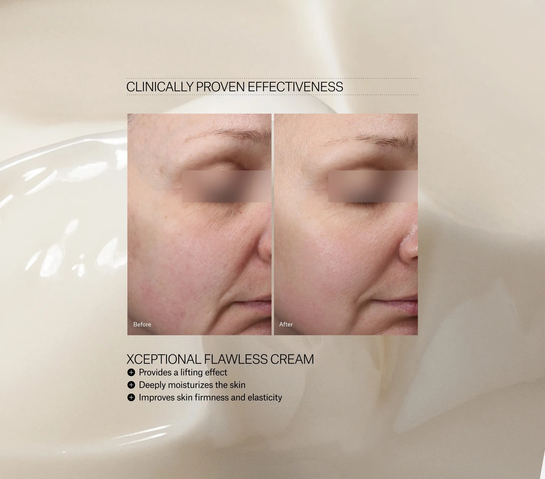Xceptional Flawless Cream Next-Gen