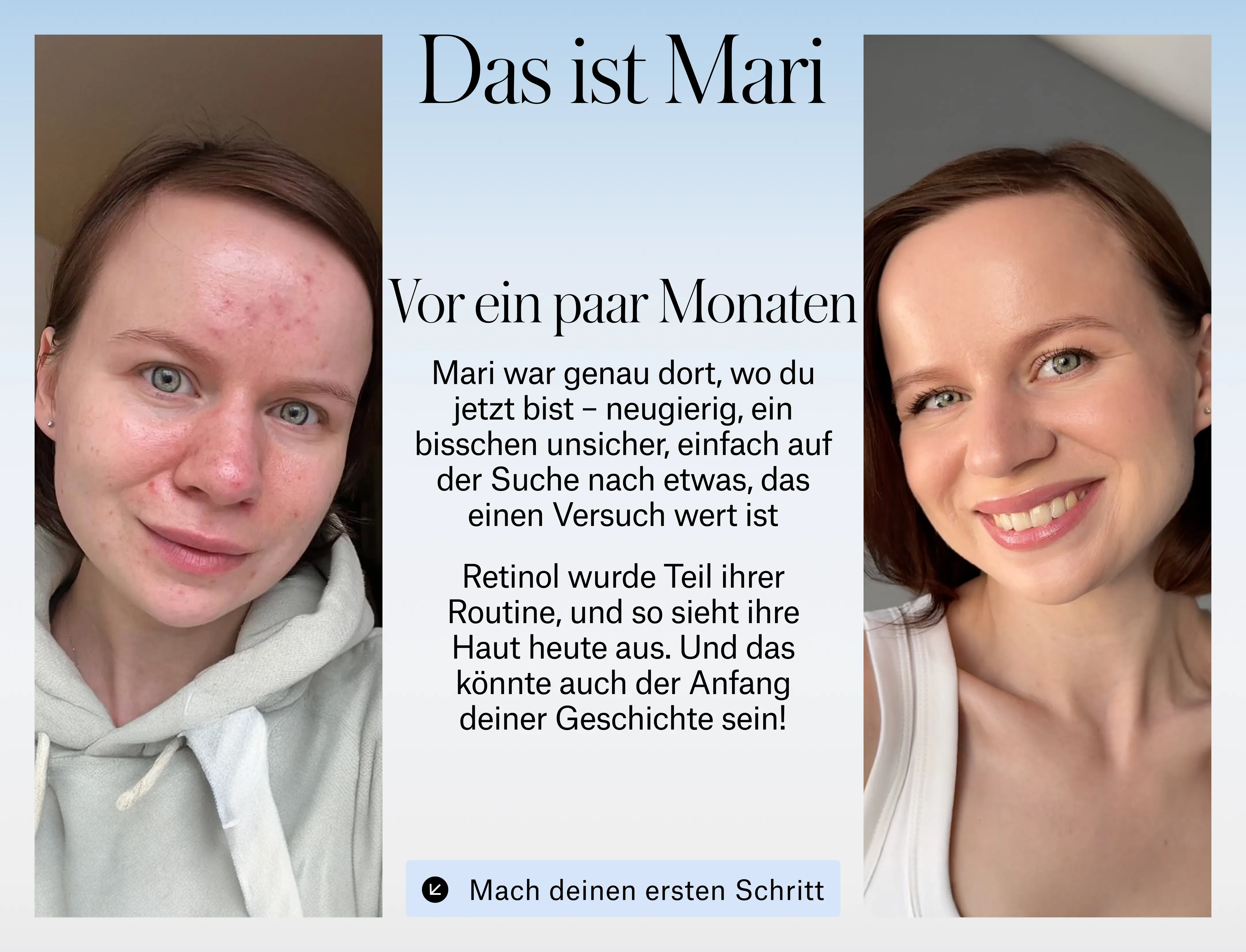 starter_de3.webp
