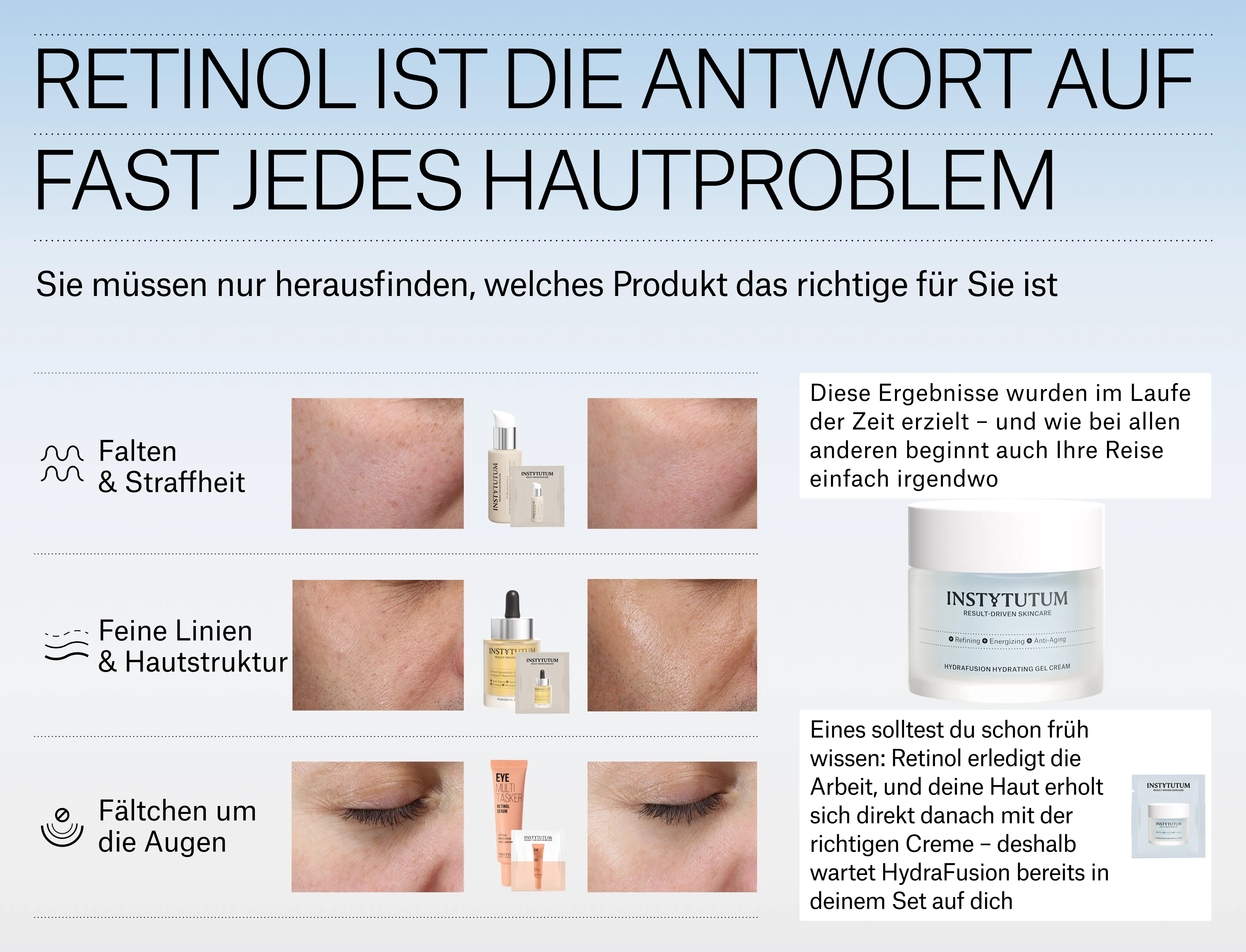 starter_de2.webp