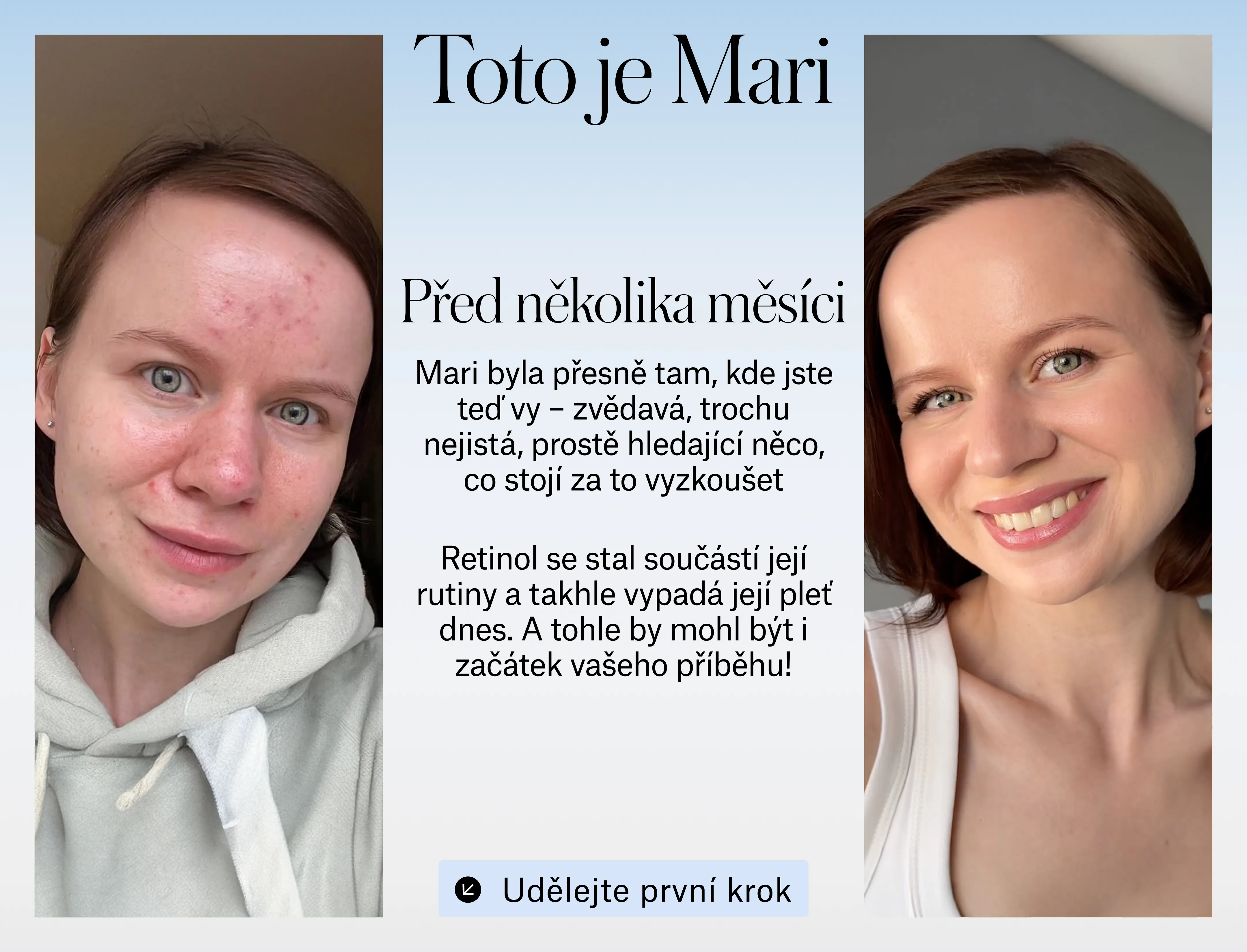 starter_cs3.webp